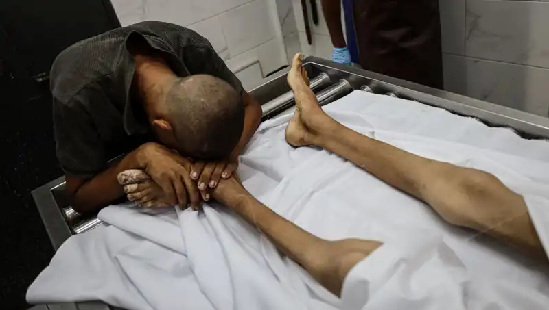 Gazze’de Açlık Korkunç Bir Gerçek: Bir Çocuk Daha Hayatını Kaybetti